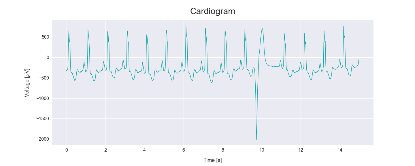 cardiogram